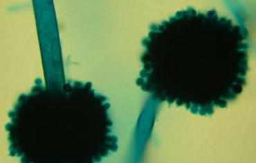 Aspergillus